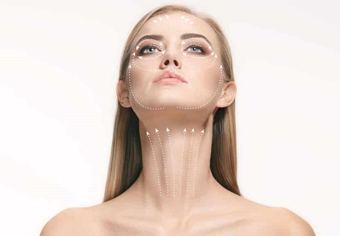 neck lift procedure